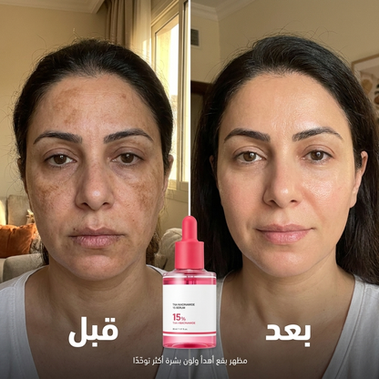 نورة™ جل ترانيكساميك أسيد